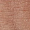 piel-deshidratada